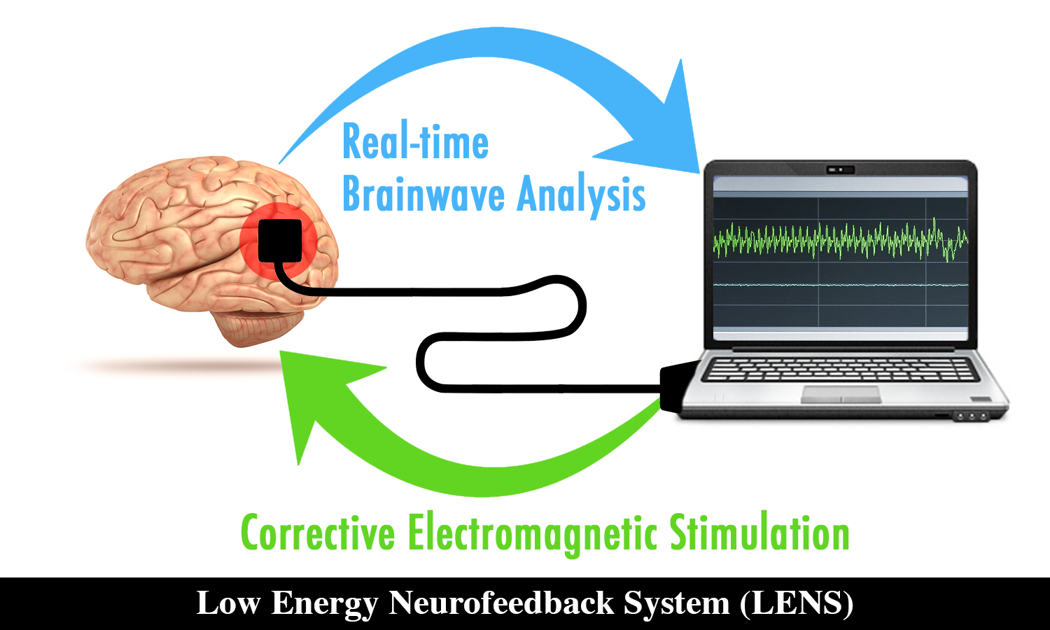 Neurofeedback – Santa Barbara Wellness For Life